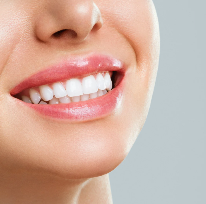 Dental Bonding Portland | Fix Chipped Teeth | Advanced Dental Arts NW